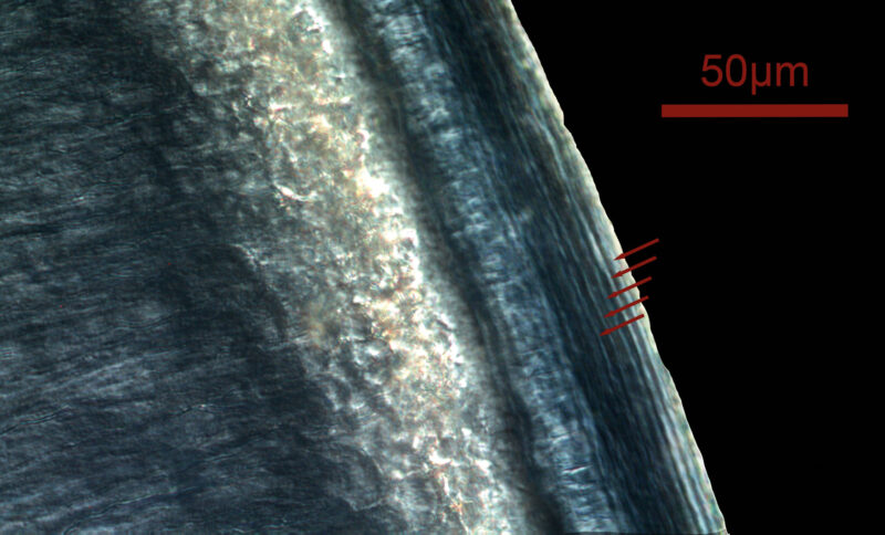 Micrograph obtained in differential interference contrast lighting (DIC) of the cross section of a human lower canine