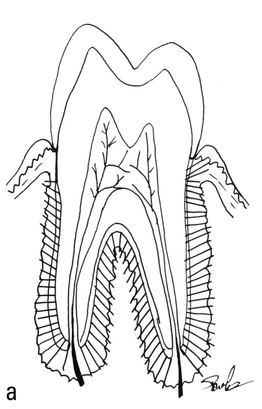 schematic drawing of a tooth